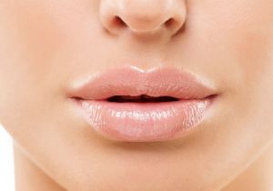 Lip Augmentation At Syracuse Plastic Surgery Skin & Wellness