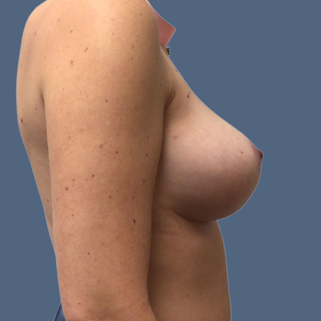 xr:d:DAFLeQNItvw:19,j:34651081053,t:22090618