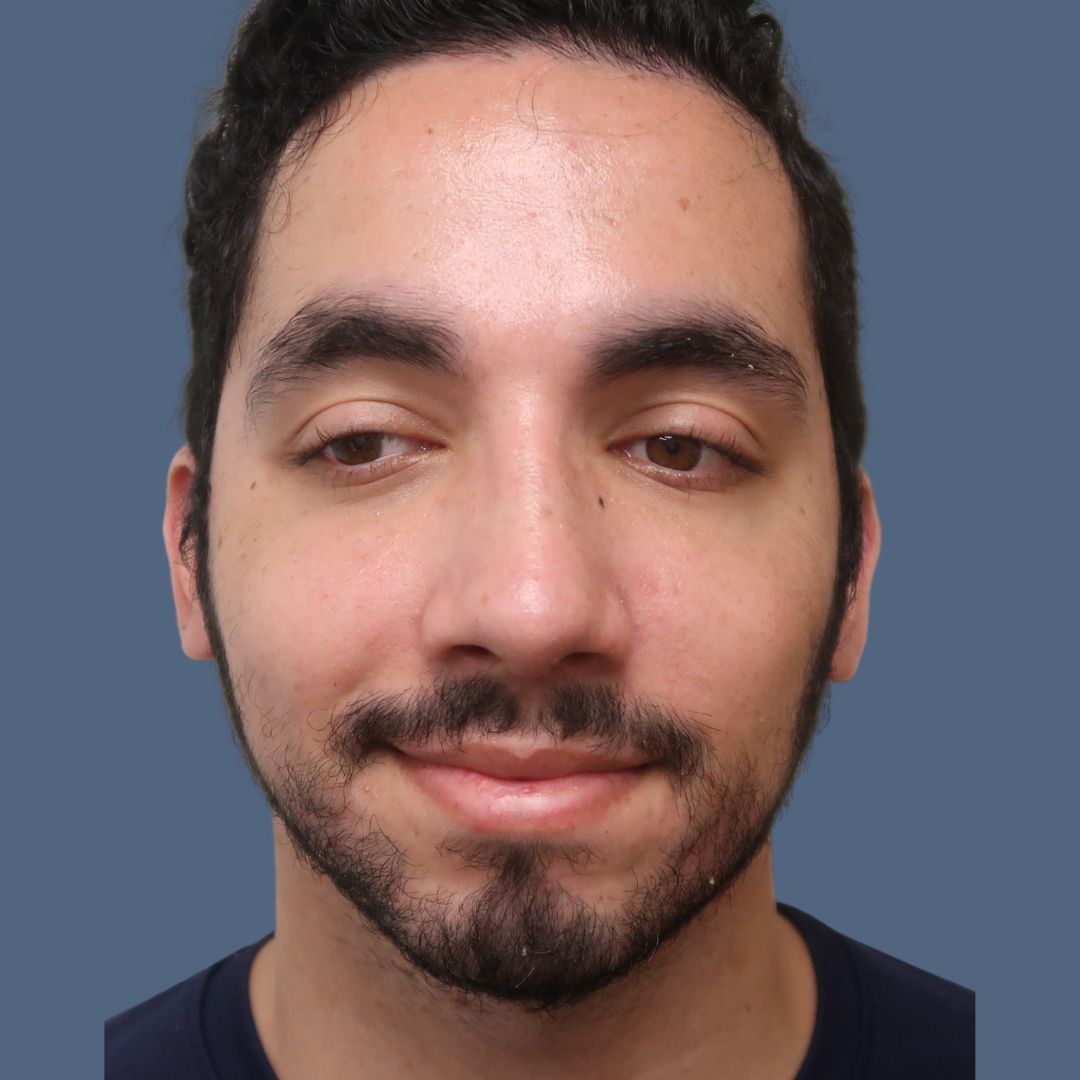 xr:d:DAFWFA1jF2s:4,j:1089535930,t:22122820