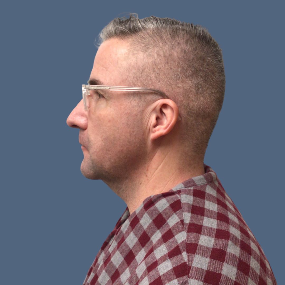 xr:d:DAFkmYFD0no:9,j:5259470553623794051,t:23060118
