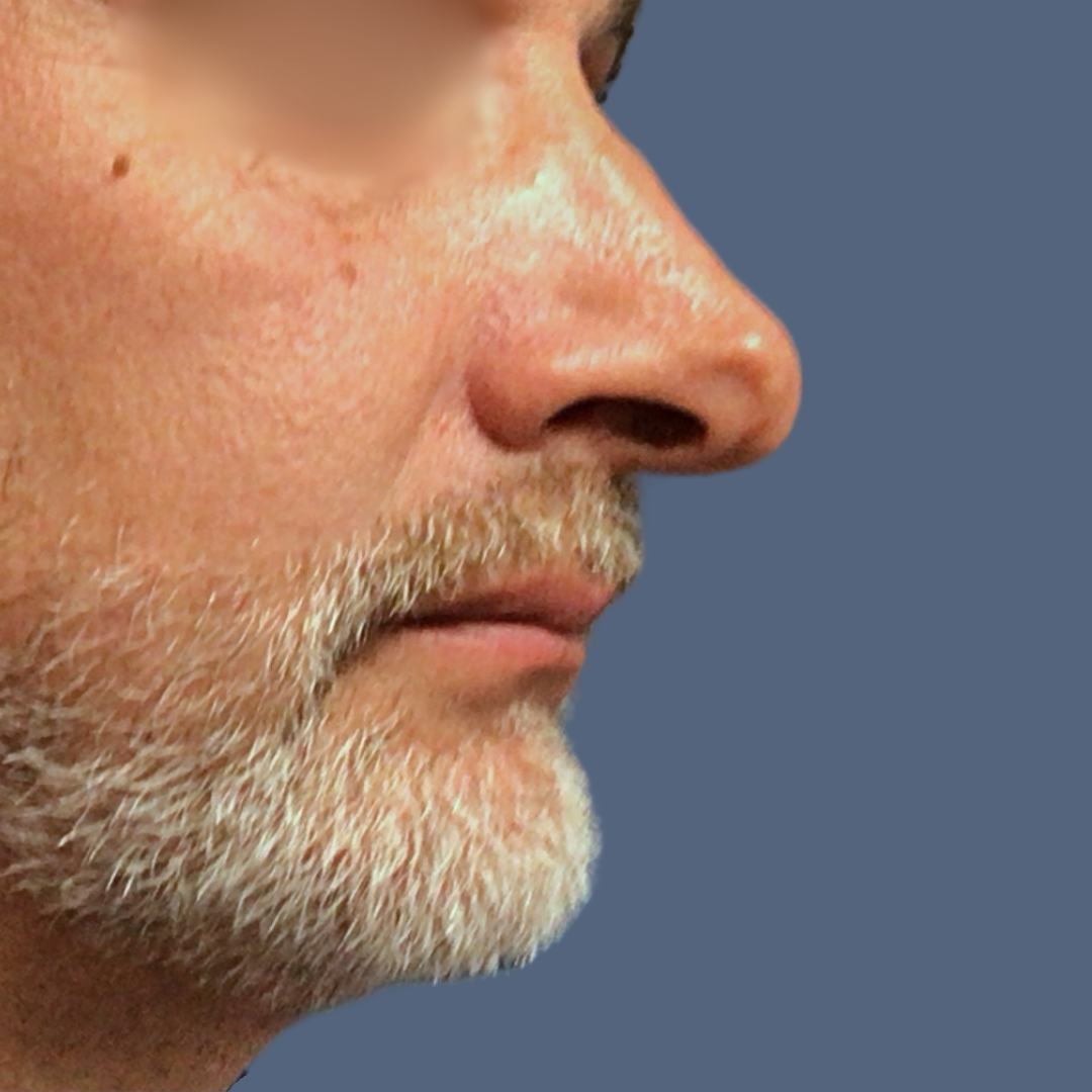 1738335860_before